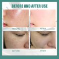 thumbnail image 4 of EIMELI Silk Protein Soap Oil Control Face Deep Cleansing Pores Mites Acne Remover, 4 of 6