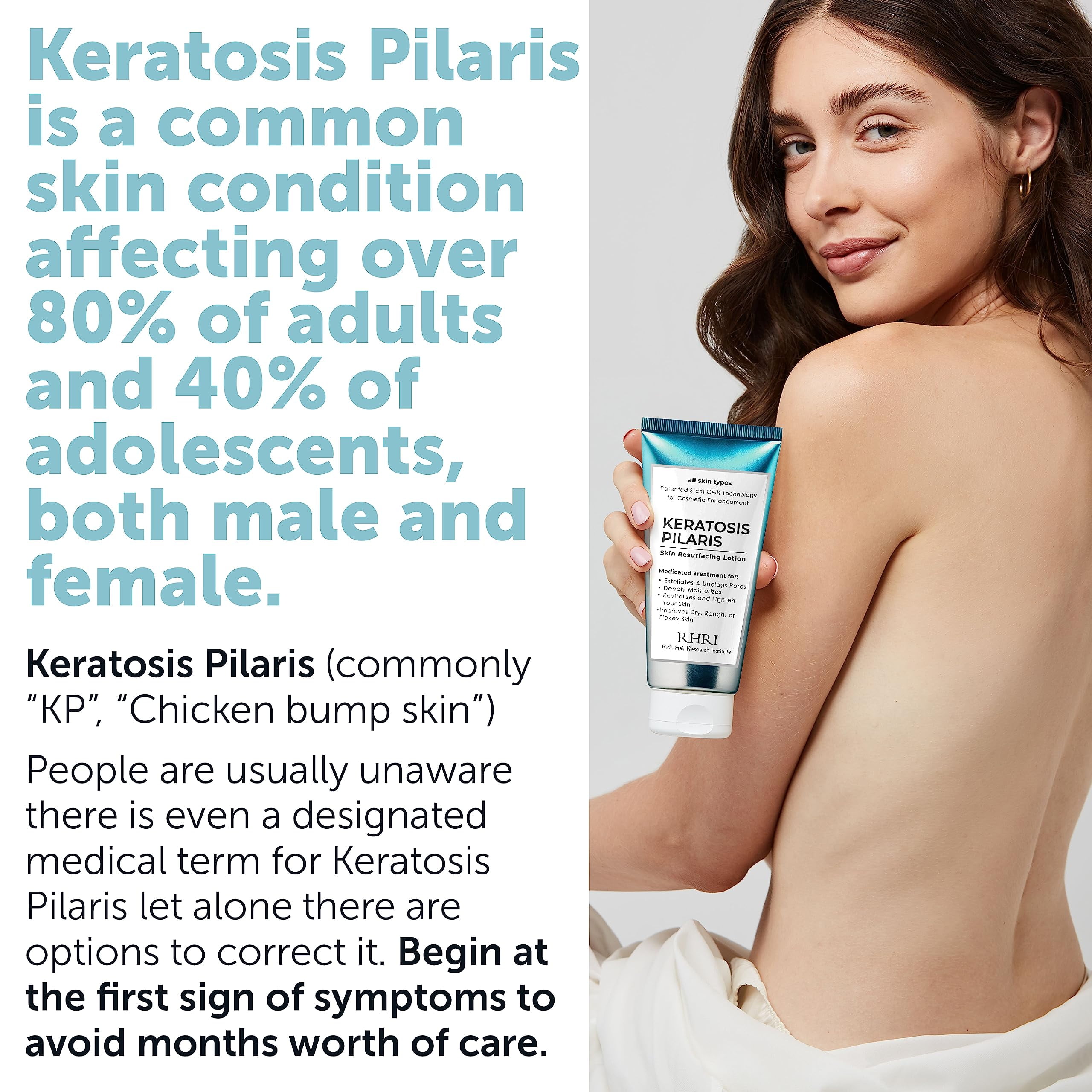 KP Bump Eraser Lotion Keratosis Pilaris Lotion with Glycolic Acid, AHA & BHA Exfoliating Rough & Bumpy Skin Body Lotion
