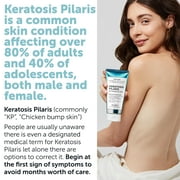 KP Bump Eraser Lotion Keratosis Pilaris Lotion with Glycolic Acid, AHA & BHA Exfoliating Rough & Bumpy Skin Body Lotion