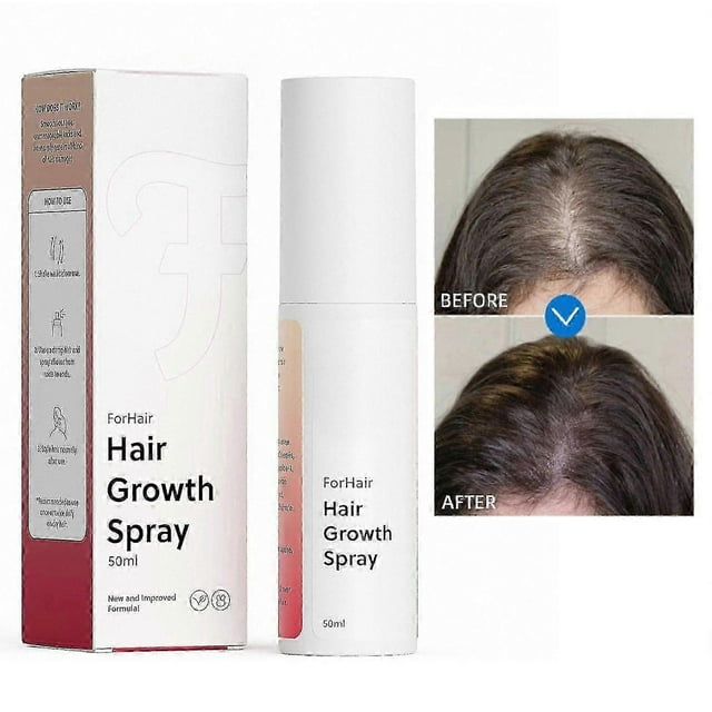 Hair Regrowth Spray - Advanced Hair Loss Solution - Promotes Hair Growth and Strengthening, Non-Greasy and Hormone-Free Formula Prevent Hair Loss