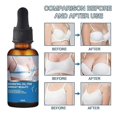 thumbnail image 5 of Breast Enlargement Oil Plant Nutrition Breast Enhancement Essential Oil Breast Massage Oil for Women, 5 of 5