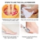 thumbnail image 4 of Minnieouse Lima para pies, afeitadora de callos de piel muerta de acero inoxidable, profesional, portátil, para el hogar, suministros de belleza Cuidado de los pies, 4 of 6