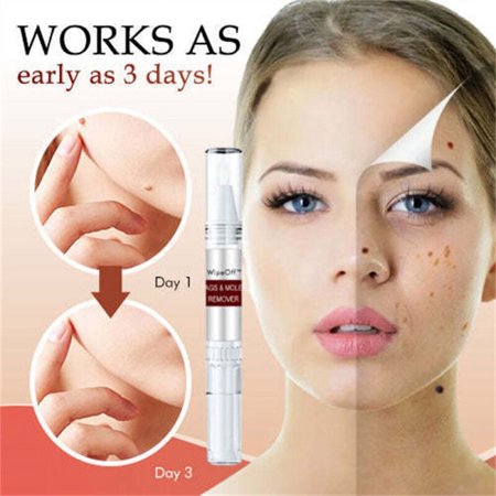 1-5x Skin Tags & Removal Quick Safe Remover Restore Skin