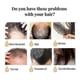 thumbnail image 3 of Rice Water Shampoo Bar Hair Growth Shampoo Soap Bar Hair Regrowth -, 3 of 5