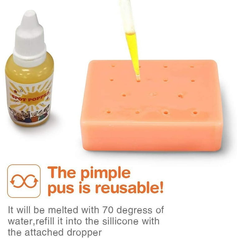 Funny Pimple Popping Popper Remover Toy With Refillable
