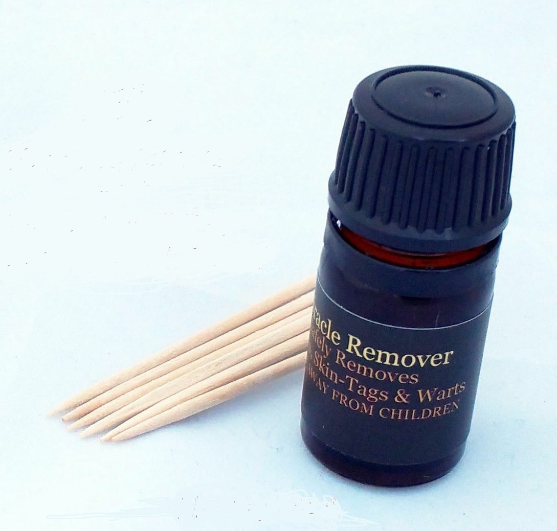 Mole Remover, Skin Tag Remover, Wart Remover