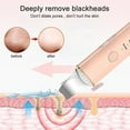 thumbnail image 2 of Ultrasonic Skin Scrubber Vibration Spatula Blackhead Remover Shovel Clean Cavitation Peeling Facial Lifting Beauty Instrument, 2 of 5