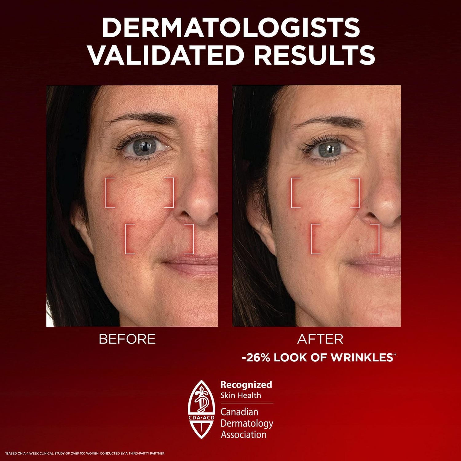 L'Oréal Paris Triple Power LZR Day Cream with Pro-Retinol, Anti-Aging Day Cream, 50 mL