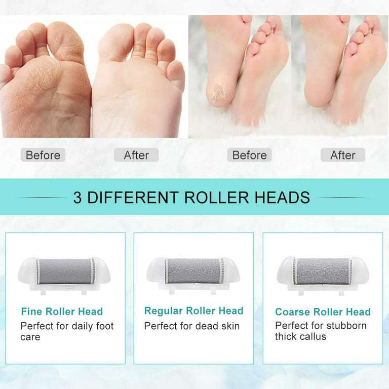  MEGAFILE Foot File Callus Remover for Feet (XL Size