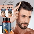 thumbnail image 6 of DHT Blocker' for Men with Saw Palmetto & Biotin, Hair Growth Formula in Liquid-Filled Caps, Hair Loss Supplements, Hair Regrowth Vitamins, Proprietary Herbal Blends - 90 Caps, 6 of 6