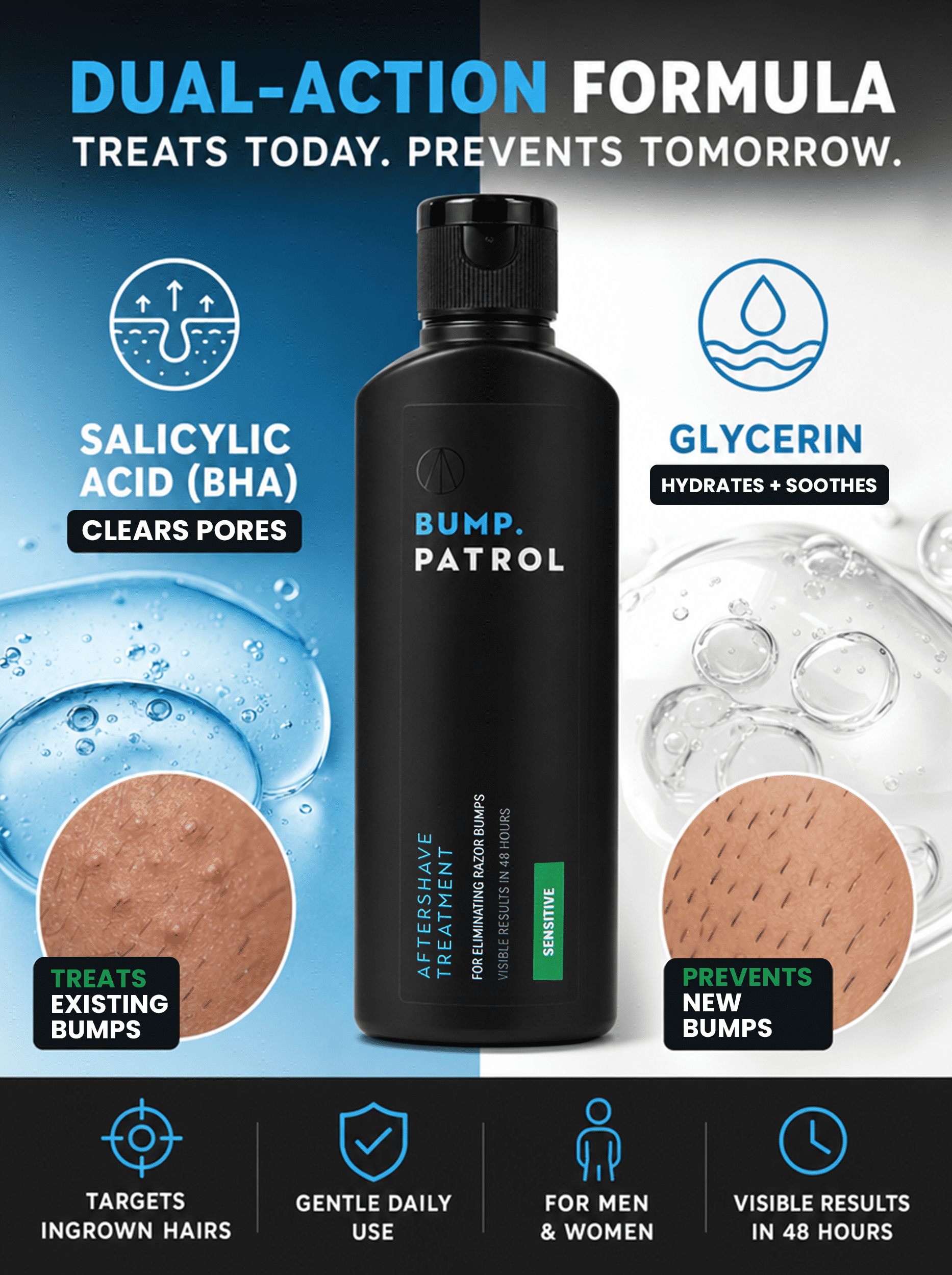 Bump Patrol Sensitive Aftershave Treatment Serum - 2 fl oz, Alcohol-free serum helps reduce razor bumps, ingrown hairs, and shaving irritation. Gentle formula for sensitive skin.