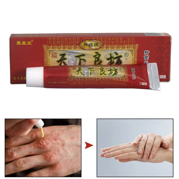 15g Antifungal Cream Antibacterial Treatment Skin Cleaning Sterization ...