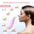 thumbnail image 2 of Vac removedor de puntos , limpiador de faciales, extractor de de acné eléctrico, herramienta de ón de puntos - Rosado Macarena aspirador removedor de espinillas, 2 of 8