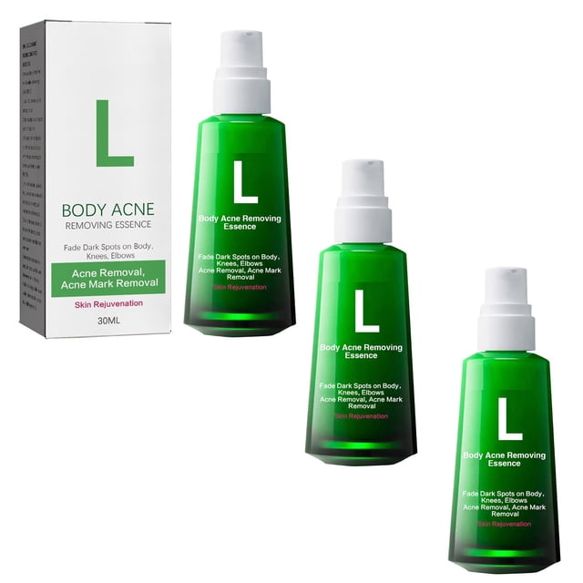 BUY 2 SAVE 10%!Maojin Acné Corporal, Para Eliminar Acné, Espinillas Y Acantosis Nigricans, Acné Corporal Para El Cuerpo, Peeling De Acné Para Espalda Y Glúteos Etc 30ml