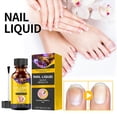 thumbnail image 2 of Cuidado de las uñas: kit suavizante para pies y uñas, nutrición para uñas de manos y pies, 15 ml cada uno, 2 of 7
