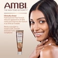 thumbnail image 3 of Sérum Ambi Even & Clear Fade Hyperpigmentation 30 ml, 3 of 8