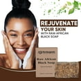 thumbnail image 5 of Herboganic Raw African Black Soap Bar - 100% Pure and Organic Natural Black African Soap, 6 oz, 5 of 11