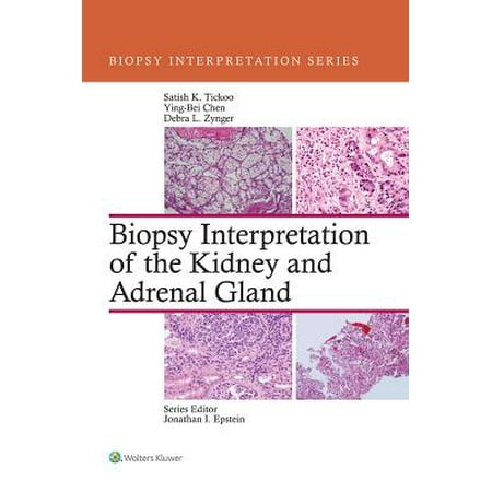 Biopsy Forcep - Biopsy Interpretation of the Kidney & Adrenal Gland - eBook