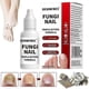 thumbnail image 2 of 15ml Fungi Nail Treatment Liquid Fast-acting Nail Repair Strengthening Liquid Nails Care Supplies 25-26, 2 of 5