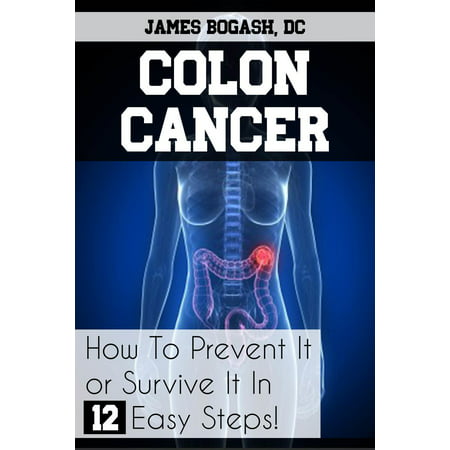 Colon Cancer: How to Prevent it or Survive it in 12 Easy Steps -
