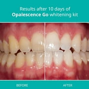 Opalescence Go 10% Prefilled Teeth Whitening Gel Trays Kit (10 Treatments) Mint Hydrogen Peroxide