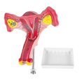 thumbnail image 4 of Life-Size Female Uterus Ovary Fallopian Tubes Model - Anatomical Teaching Tool with Base | 18cm PVC Medical Model for Education, 4 of 5