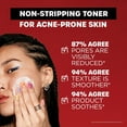 thumbnail image 3 of Thayers 2% d'acide salicylique SA Toner, 3 of 7