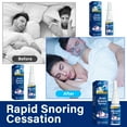 thumbnail image 3 of Anti Snoring Devices, Anti Snoring Spray Provide the Effective Snoring Solution, 3 of 8