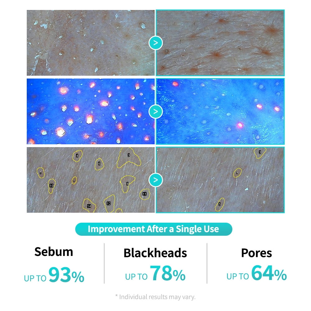 essl Centella Poreless Patch, 8ea