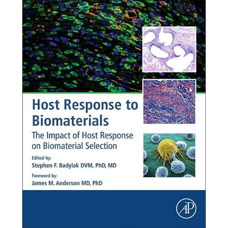 UPC: 9780128001967 | Host Response to Biomaterials: The Impact of Host Response on Biomaterial Selection (Hardcover)