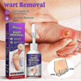thumbnail image 2 of 2pcs Corn Removal Extra Strengthen Gel Foot Callus Removal Treatment Hard Skin, 2 of 3