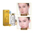 thumbnail image 3 of 1-3 piezas de hilo de colágeno antiarrugas de proteína dorada sin agujas para lifting facial, absorbible, reafirmante, antienvejecimiento, que atenúa las líneas finas, 3 piezas, 3 of 5