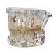 thumbnail image 5 of Demostración dental Modelo de dientes Educación dental Prótesis dental ligera Educar transparente, 5 of 9