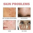 5 In 1 Facial Mousse Deep Cleansing Oil Skin Reduce & Dark Spot Cleanser Breakouts Deep