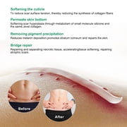 ALIVER Scar Cream, Stretch Marks Remover, Ideal for Acne, C-Section, Burns, Surgical Scars Treatment, Effective for Old and New Scars, 1.7 oz