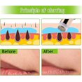 thumbnail image 4 of Removedor de vello facial KEWITY impecable para mujeres portátil, 4 of 5