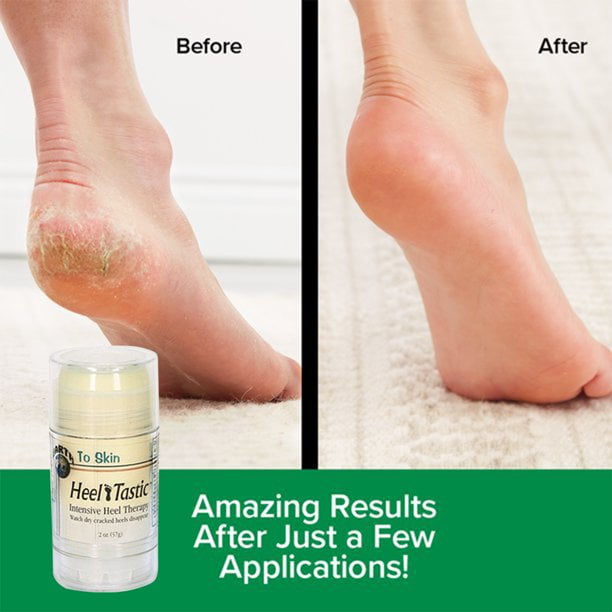 Heeltastic Therapy Balm Foot Massage Cream Intensive Heel Therapy Foot Care