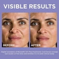 thumbnail image 3 of L’Oreal Revitalift. Suero de ácido hialurónico para la piel al 1.5% L'Oréal 1, 3 of 4