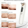 thumbnail image 3 of Pore Vacuum Blackhead Removal Kit - 4 Suction Heads & Squeezer Tool, Adjustable Suction - Unisex Facial Pore Cleansing (Wireless Electric White), 3 of 5