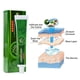 thumbnail image 4 of Crema para eczema, dermatitis, prurito, psoriasis, ungüento antipicazón, 4 of 7