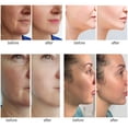 thumbnail image 4 of Aphrona Galvanic Spa - Dispositivo de tonificación facial - Dispositivo de tono facial Gua Sha de microcorriente - Reafirmante de la piel - Masajeador facial aprobado por la FDA, 4 of 5