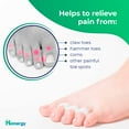 thumbnail image 2 of Hammer Toe Straightener - Hammer Toe Corrector for Women and Men - Gel Toe Separators for Overlapping Toes -- 4 Pack, 2 of 5