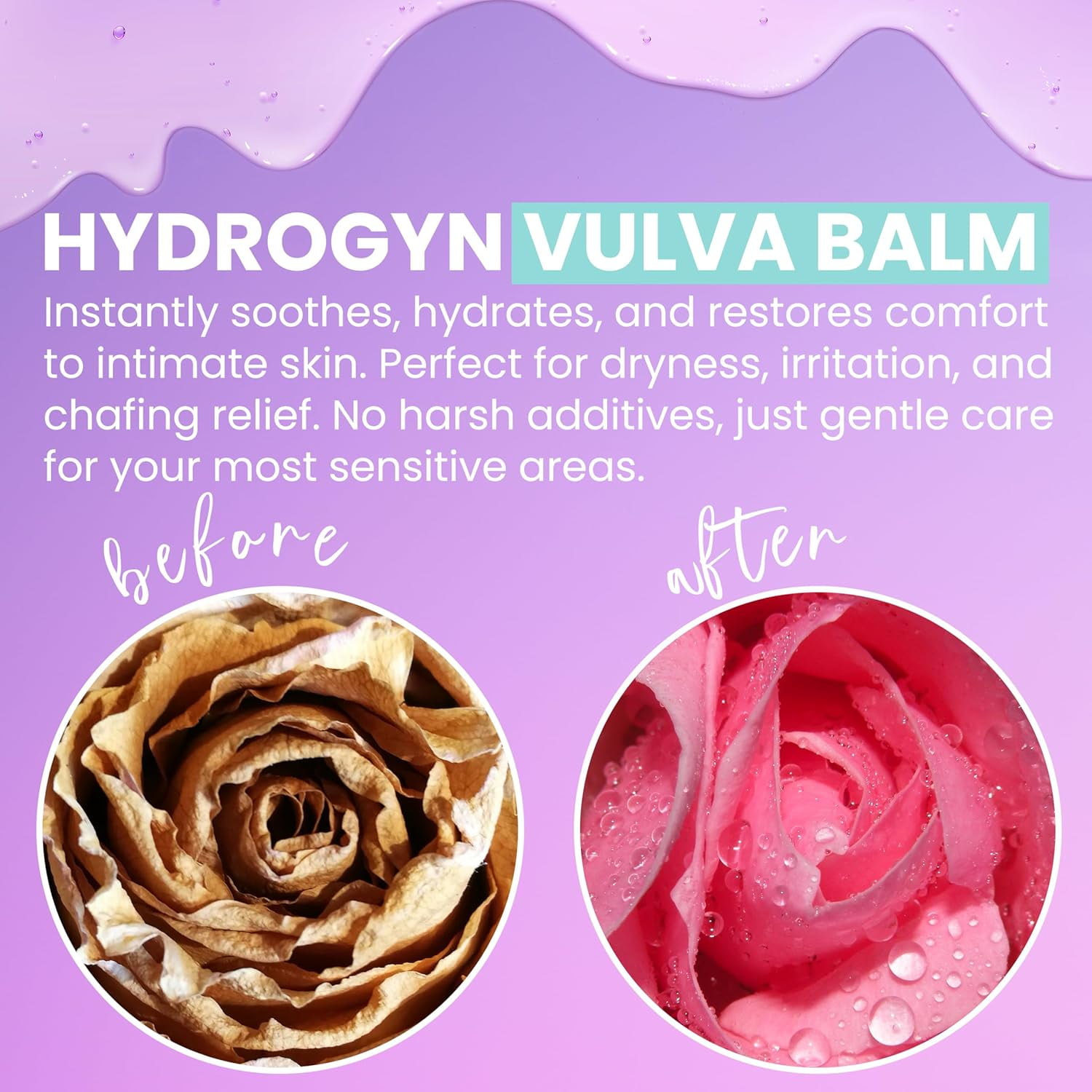 HydroGyn Vulva Balm | Vaginal Moisturizer for Women | Feminine Intimate Care Balm for Dryness, Itching & Comfort Support | Hormone-Free pH Balanced Daily Intimate Skin Care