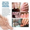 thumbnail image 5 of Nail Repair and Care Spray for Hands, Feet, and Nails - Strengthens, Cleans, and Polishes - 100ml, 5 of 5