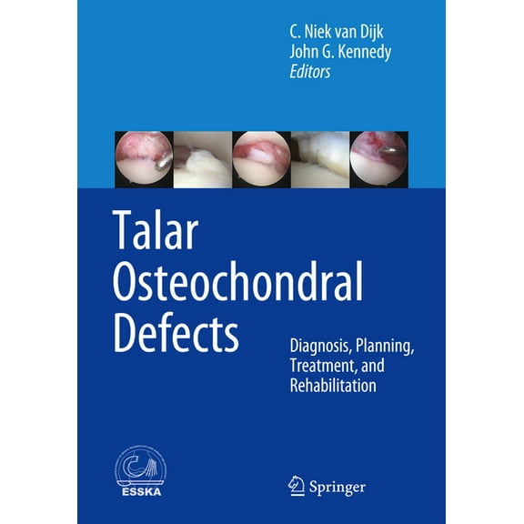 Talar Osteochondral Defects: Diagnosis, Planning, Treatment, and Rehabilitation, (Hardcover)