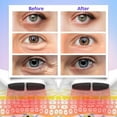 thumbnail image 4 of Eye Skin Care Red Light Therapy Device 3d Eye Beauty Massager With Vibration Gift For Mother's Day, 4 of 5