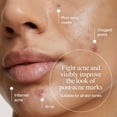 thumbnail image 4 of Neutrogena Evenly Clear Retinoid, Adapalene Gel 0.1%, 0.5 oz, 4 of 13