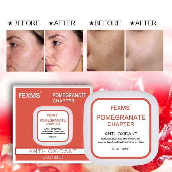 Gzwccvsn Pomegranate Cream, Light Acnes Afters Sunburn Repair Moisturizing Moisturizing Moisturizing Gel Cream 30ML, Moisturizers Skincare Products