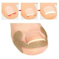 thumbnail image 7 of opvise 1 Set Ingrown Toenail Treatment Breathable No Glue Patch Strips Painless Professional Nail Adjuster Pedicure Tool Toenail Correction Khaki, 7 of 7