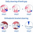 thumbnail image 3 of 4-pack intermittent toothbrush, short handle soft-bristle floss toothpick, reusable floss toothpick orthodontic teeth cleaning tool (yellow (0.7)), 3 of 4